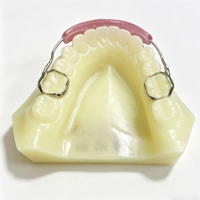 Custom Orthodontic Appliances for Malocclusion Correction