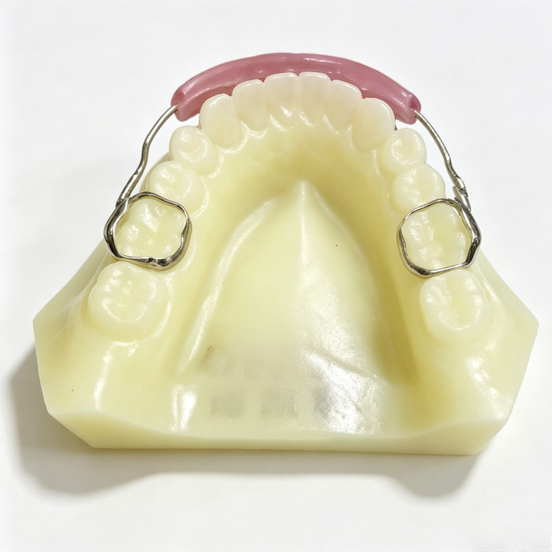 Custom Orthodontic Appliances for Malocclusion Correction