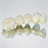 Custom Fixed Dental Prostheses – Crowns & Bridges