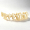 3M Lava™ Zirconia All-Ceramic Restorations for Crowns & Bridges