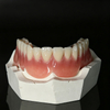 Custom Removable Dental Prostheses – Partial & Complete Dentures