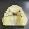Custom Orthodontic Appliances for Malocclusion Correction