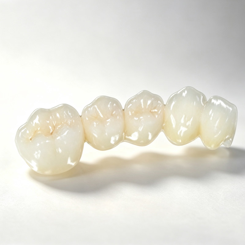 Cercon Zirconia All-Ceramic Dental Crowns