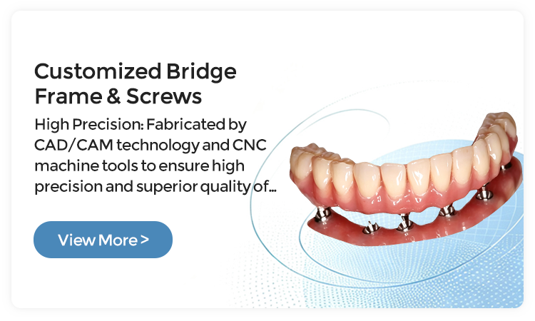 Customized-Bridge-