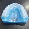 Custom Orthodontic Appliances for Malocclusion Correction
