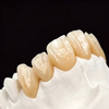 Custom Fixed Dental Prostheses – Crowns & Bridges