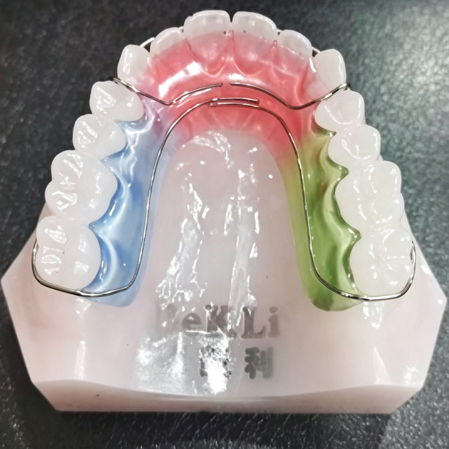 Custom Hawley Retainer with C-Clasp for Orthodontic Retention