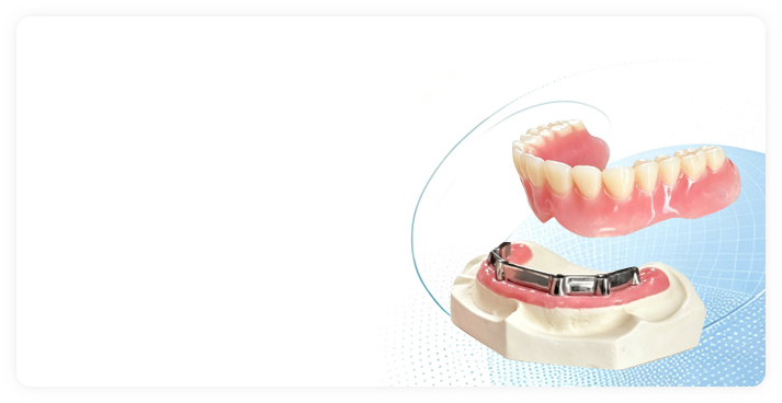 Customized-Bar-Attachment-&-Screws