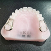 Custom Orthodontic Space Maintainer for Premature Tooth Loss