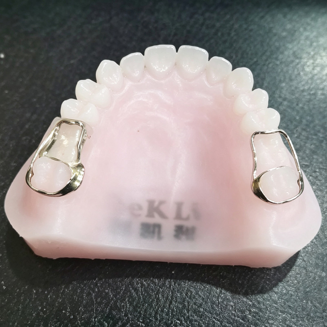 Custom Orthodontic Space Maintainer for Premature Tooth Loss