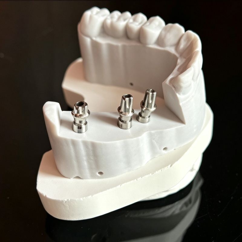Custom Abutments & Screws