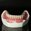 Custom Removable Dental Prostheses – Partial & Complete Dentures