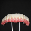 Custom Dental Implant Frameworks & Screws for Full-Arch Restorations