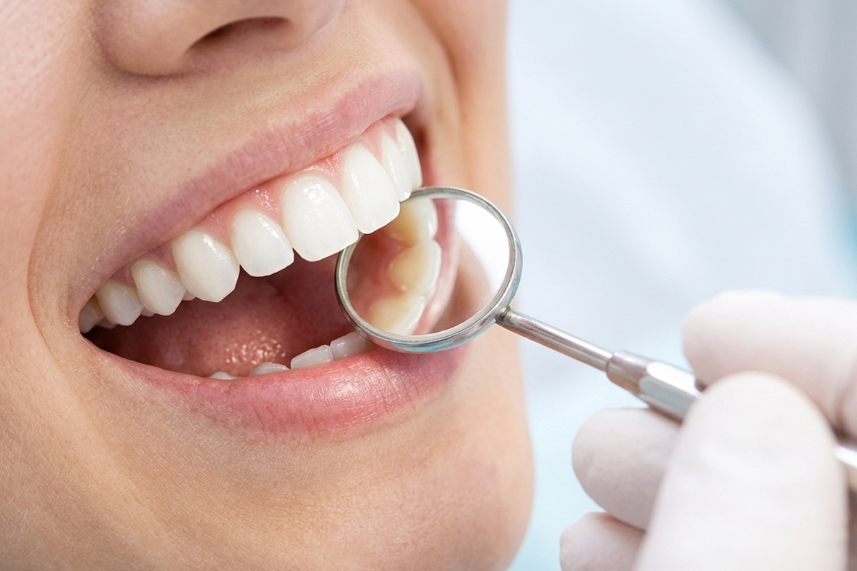 Anterior Aesthetic Restoration Solution for Dental Clinics