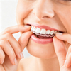 Custom Orthodontic Appliances for Malocclusion Correction
