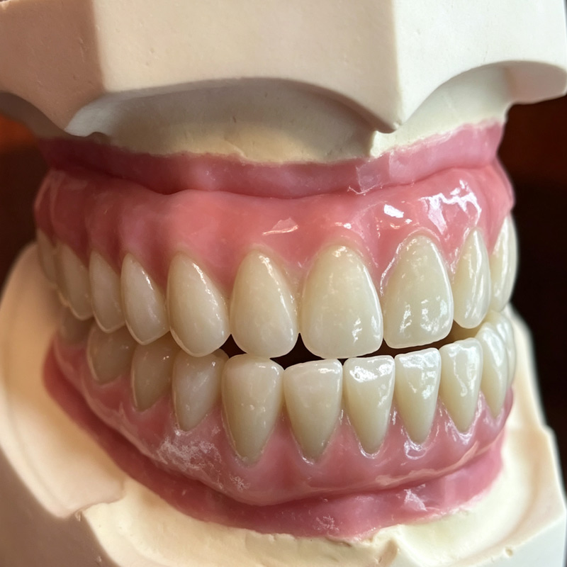 Custom Dental Implant Frameworks & Screws for Full-Arch Restorations
