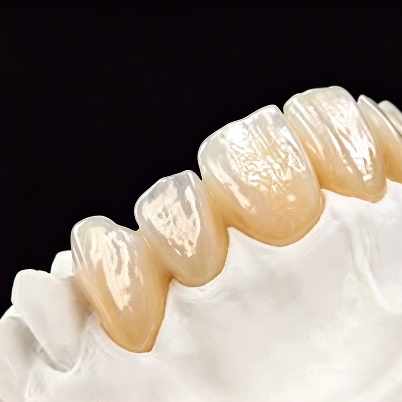 VITA Zirconia All-Ceramic Dental Crowns