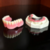 Custom Dental Implant Frameworks & Screws for Full-Arch Restorations