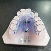 Custom Orthodontic Appliances for Malocclusion Correction