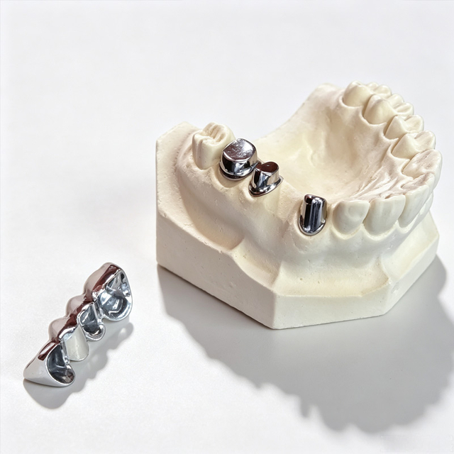 Custom Implant-Supported Hybrid Prostheses for Full-Arch Restoration