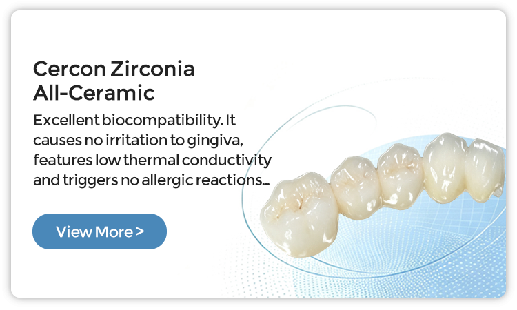 Cercon-Zirconia-All-Ceramic-